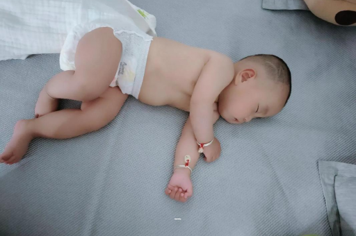 高平宝宝脸上有白色斑块